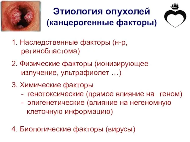 Этиология опухолей (канцерогенные факторы) 1. Наследственные факторы (н-р, ретинобластома) 2. Физические