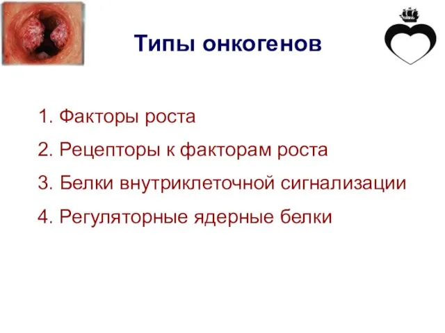 Типы онкогенов 1. Факторы роста 2. Рецепторы к факторам роста 3.