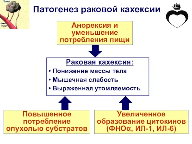 Патогенез раковой кахексии Раковая кахексия: Понижение массы тела Мышечная слабость Выраженная