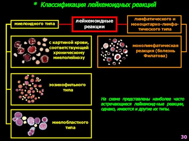 * Классификация лейкемоидных реакций лейкемоидные реакции миелоидного типа лимфатического и моноцитарно-лимфа-