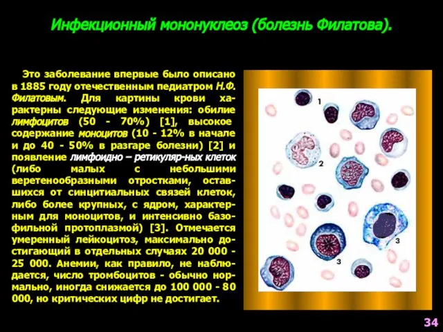 Инфекционный мононуклеоз (болезнь Филатова). Это заболевание впервые было описано в 1885