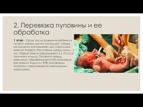 2. Перевязка пуповины и ее обработка 1 этап - Сразу после