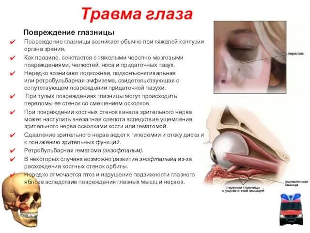 Повреждение глазницы Повреждение глазницы возникает обычно при тяжелой контузии органа зрения.