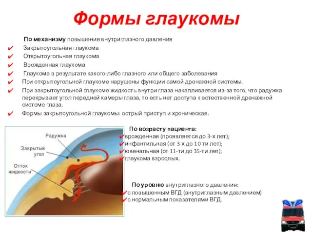 Формы глаукомы По механизму повышения внутриглазного давления Закрытоугольная глаукома Открытоугольная глаукома