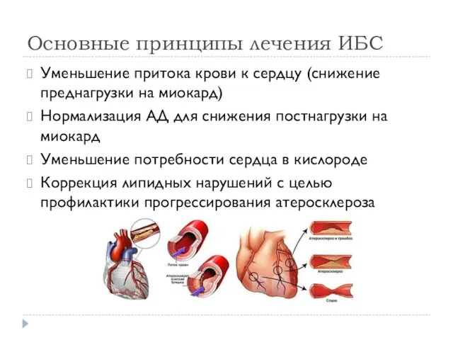 Основные принципы лечения ИБС Уменьшение притока крови к сердцу (снижение преднагрузки