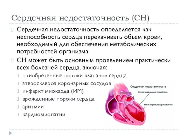 Сердечная недостаточность (СН) Сердечная недостаточность определяется как неспособность сердца перекачивать объем