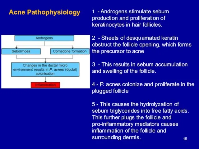 1 - Androgens stimulate sebum production and proliferation of keratinocytes in