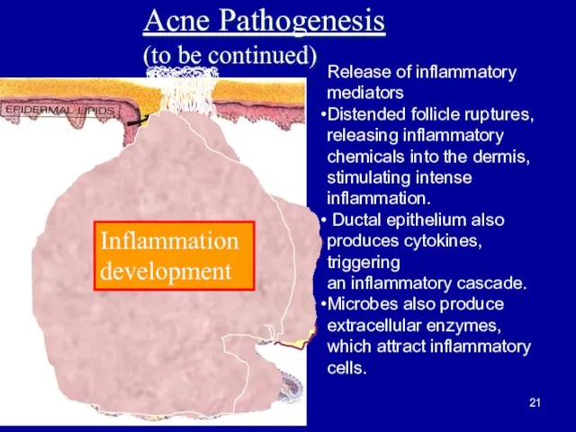 Inflammation development Acne Pathogenesis (to be continued) Release of inflammatory mediators