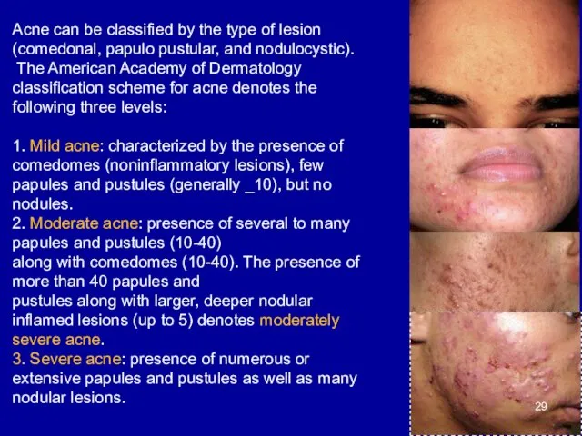 Acne can be classified by the type of lesion (comedonal, papulo