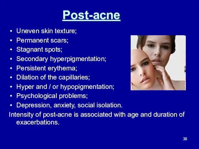 Post-acne Uneven skin texture; Permanent scars; Stagnant spots; Secondary hyperpigmentation; Persistent
