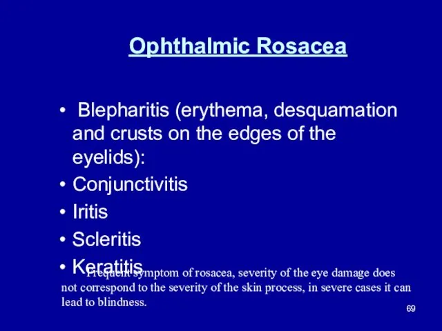 Ophthalmic Rosacea Blepharitis (erythema, desquamation and crusts on the edges of