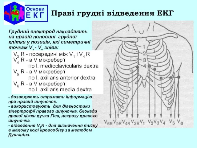 Основи Е К Г Праві грудні відведення ЕКГ Грудний електрод накладають