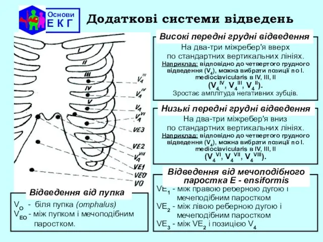 Основи Е К Г Додаткові системи відведень На два-три мiжребер'я вверх