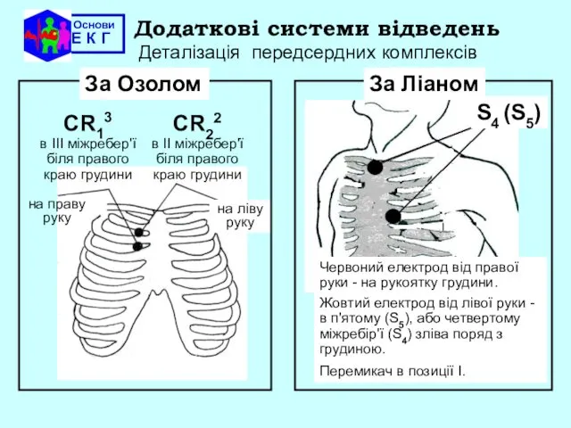 Основи Е К Г Додаткові системи відведень CR13 в III мiжребер'ї