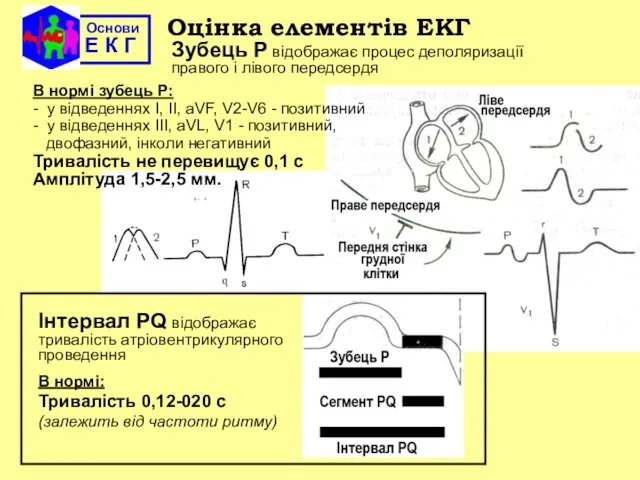 Основи Е К Г Оцінка елементів ЕКГ Зубець Р відображає процес