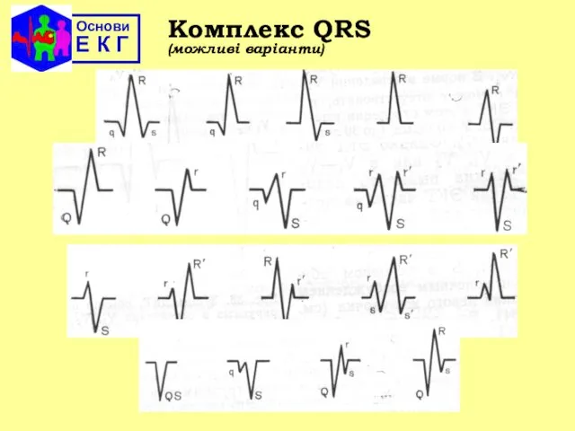 Основи Е К Г Комплекс QRS (можливі варіанти)