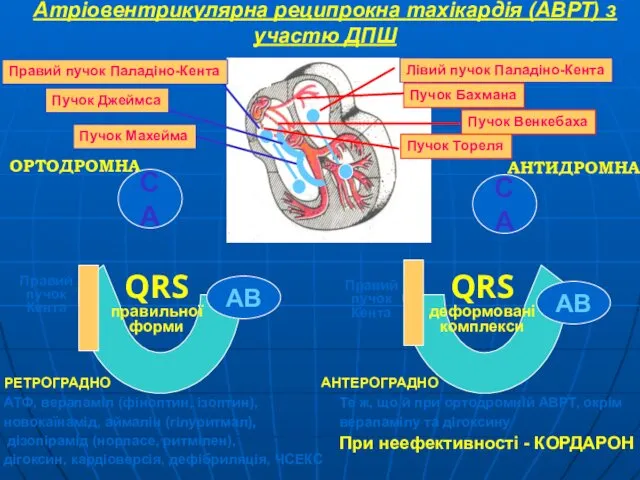 СА СА АВ АВ Правий пучок Кента Правий пучок Кента РЕТРОГРАДНО