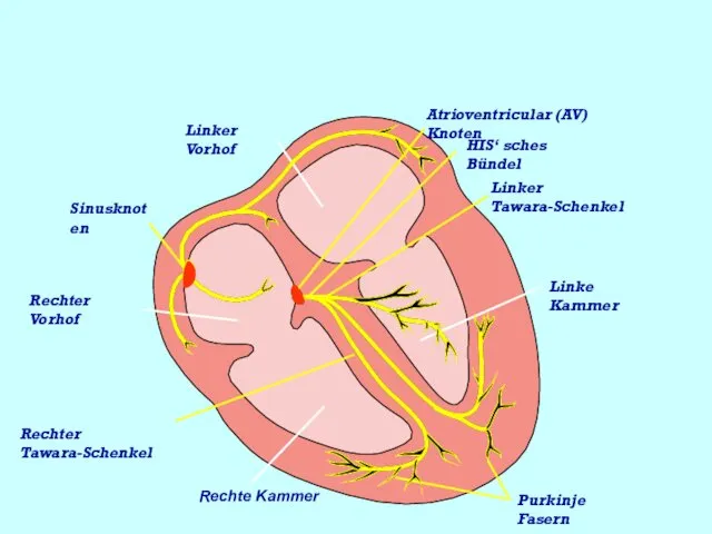 Linker Vorhof Atrioventricular (AV) Knoten HIS‘ sches Bündel Linker Tawara-Schenkel Linke