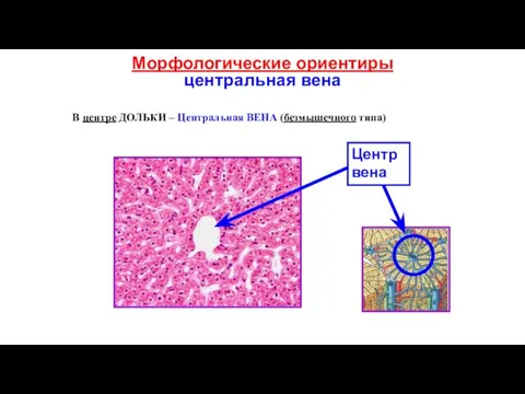 Морфологические ориентиры центральная вена Центр вена В центре ДОЛЬКИ – Центральная ВЕНА (безмышечного типа)