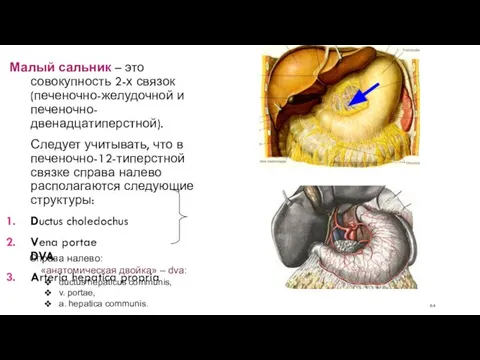 Малый сальник – это совокупность 2-х связок (печеночно-желудочной и печеночно-двенадцатиперстной). Следует