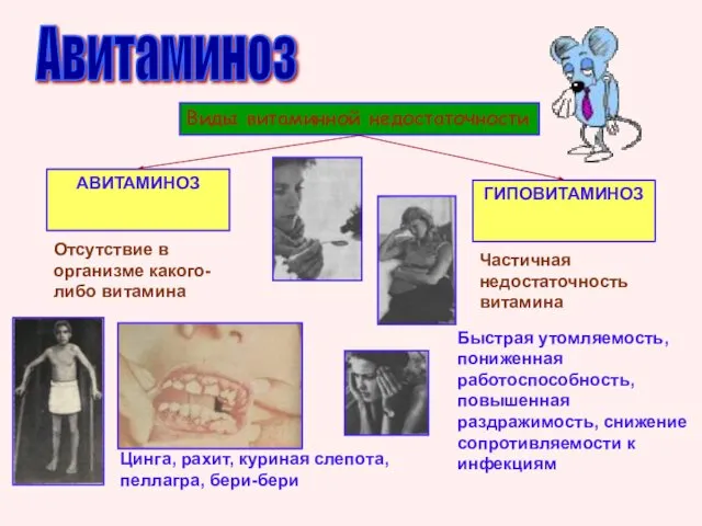 Авитаминоз Виды витаминной недостаточности АВИТАМИНОЗ ГИПОВИТАМИНОЗ Отсутствие в организме какого-либо витамина