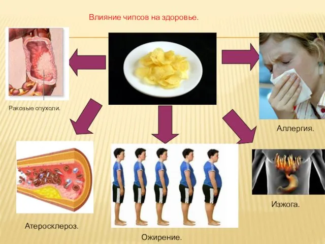 Влияние чипсов на здоровье. Раковые опухоли. Атеросклероз. Ожирение. Аллергия. Изжога.