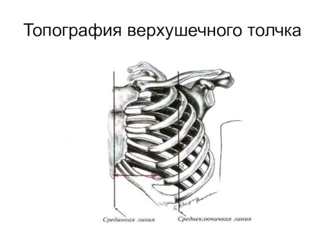 Топография верхушечного толчка