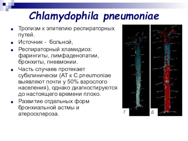 Chlamydophila pneumoniae Тропизм к эпителию респираторных путей. Источник - больной, Респираторный