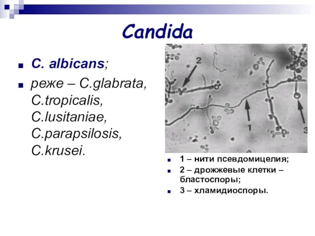 Candida C. аlbicans; реже – C.glabrata, C.tropicalis, C.lusitaniae, C.parapsilosis, C.krusei. 1