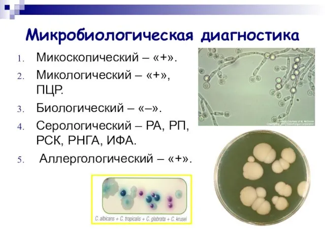 Микробиологическая диагностика Микоскопический – «+». Микологический – «+», ПЦР. Биологический –