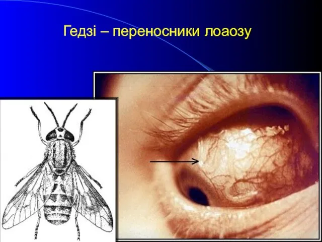 Гедзі – переносники лоаозу