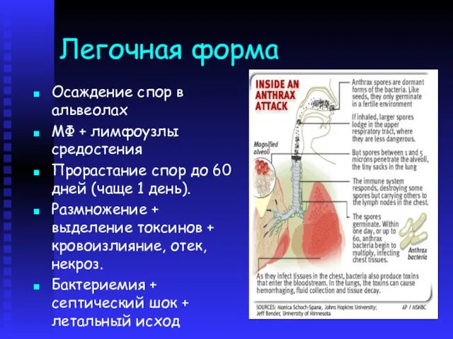 Легочная форма Осаждение спор в альвеолах МФ + лимфоузлы средостения Прорастание