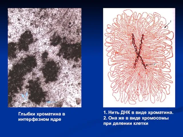 Глыбки хроматина в интерфазном ядре 1. Нить ДНК в виде хроматина.