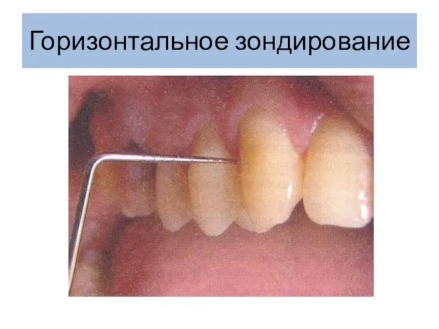 Горизонтальное зондирование