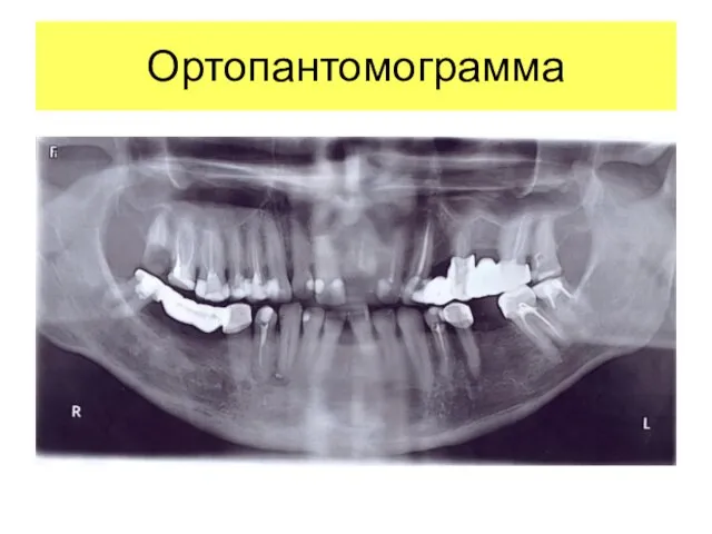 Ортопантомограмма