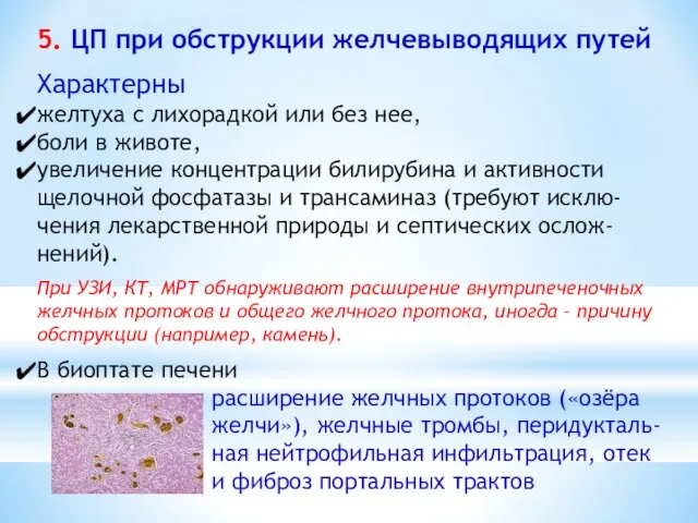 5. ЦП при обструкции желчевыводящих путей Характерны желтуха с лихорадкой или