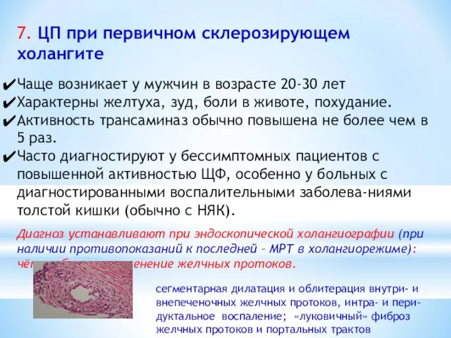 7. ЦП при первичном склерозирующем холангите Чаще возникает у мужчин в