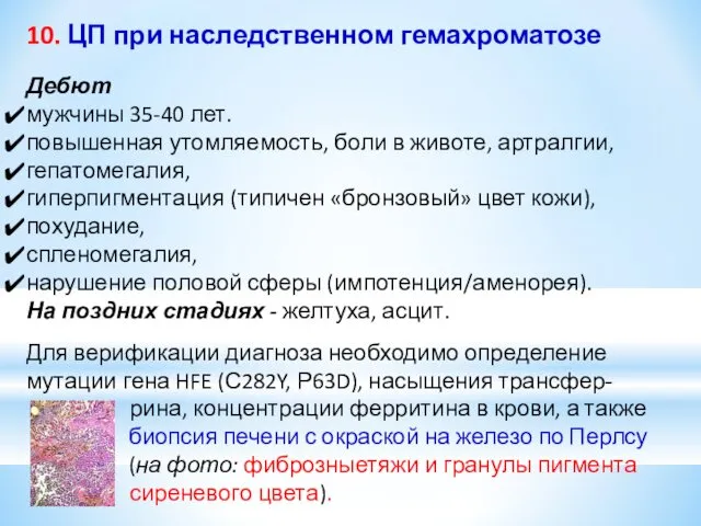 10. ЦП при наследственном гемахроматозе Дебют мужчины 35-40 лет. повышенная утомляемость,