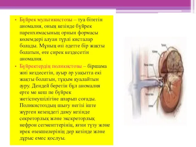 Бүйрек мультикистозы – туа бітетін аномалия, оның кезінде бүйрек паренхимасының орнын