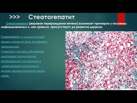 >>> Стеатогепатит Стеатогепатит (жировое перерождение печени) возникает примерно у половины инфицированных