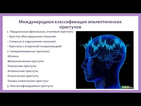 Международная классификация эпилептических приступов 1. Парциальные (фокальные, очаговые) приступы Простые (без