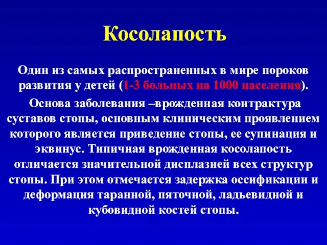 Косолапость Один из самых распространенных в мире пороков развития у детей