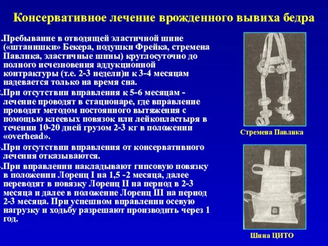 Консервативное лечение врожденного вывиха бедра Пребывание в отводящей эластичной шине («штанишки»