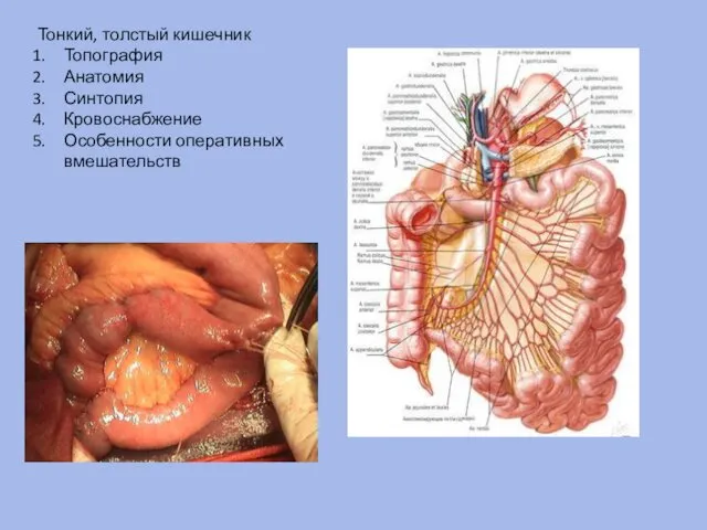 Тонкий, толстый кишечник Топография Анатомия Синтопия Кровоснабжение Особенности оперативных вмешательств