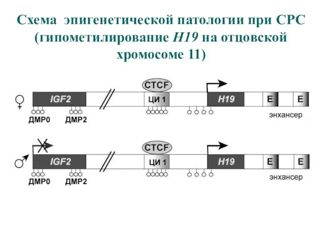 Схема эпигенетической патологии при СРС (гипометилирование H19 на отцовской хромосоме 11)