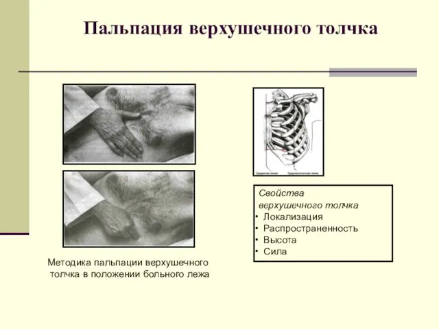 Пальпация верхушечного толчка Методика пальпации верхушечного толчка в положении больного лежа