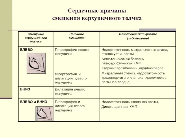 Сердечные причины смещения верхушечного толчка