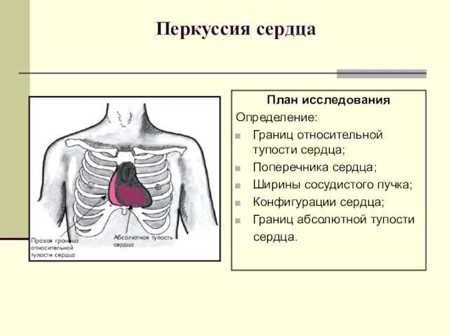 Перкуссия сердца План исследования Определение: Границ относительной тупости сердца; Поперечника сердца;