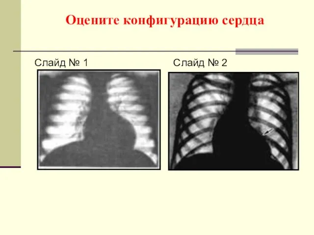 Оцените конфигурацию сердца Слайд № 1 Слайд № 2