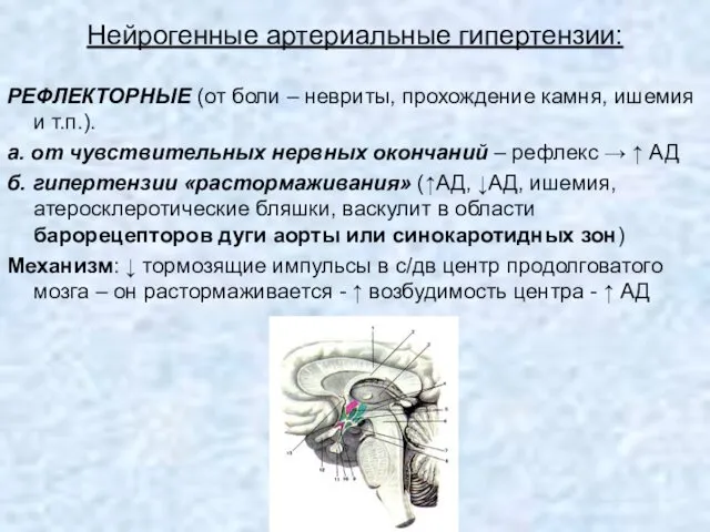 Нейрогенные артериальные гипертензии: РЕФЛЕКТОРНЫЕ (от боли – невриты, прохождение камня, ишемия